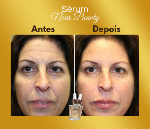 Antes e depois - Ana P.