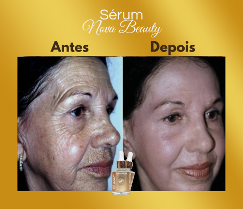 Antes e depois - Rosa S.