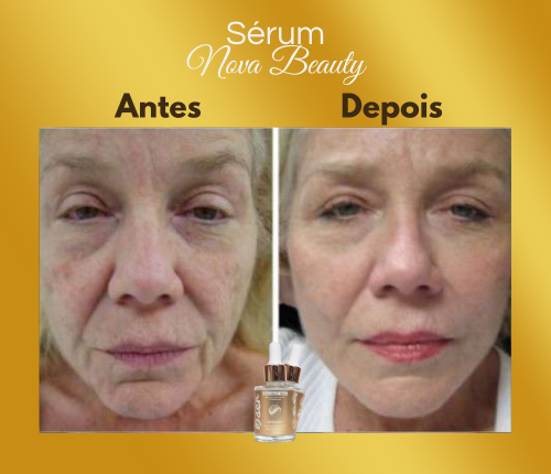 Antes e depois - Helena M.
