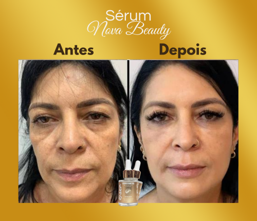 Antes e depois - Cláudia R.
